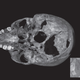 Image for article titled Modern Forensics Reveal Gruesome Details Of King Richard III's Death